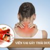 Viên vai gáy Thái Dương