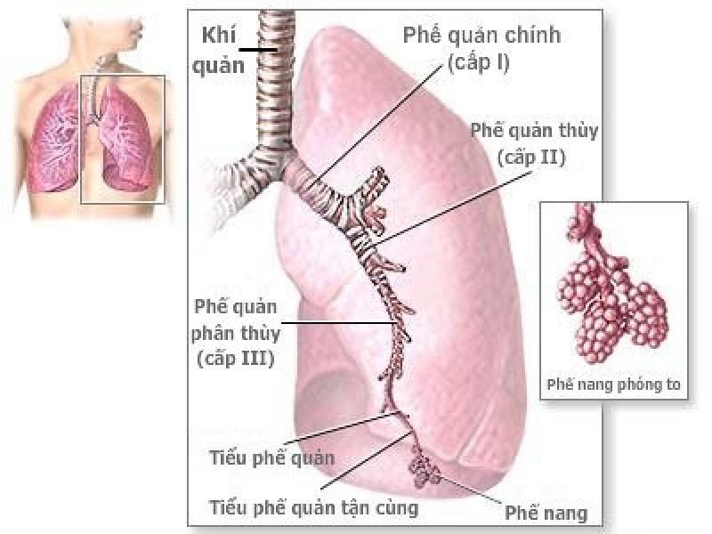 các loại viêm phổi ở trẻ em