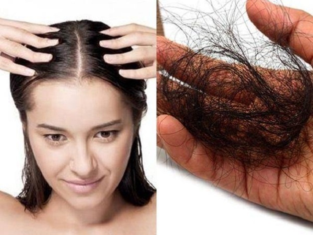 Những nguyên nhân gây rụng tóc
